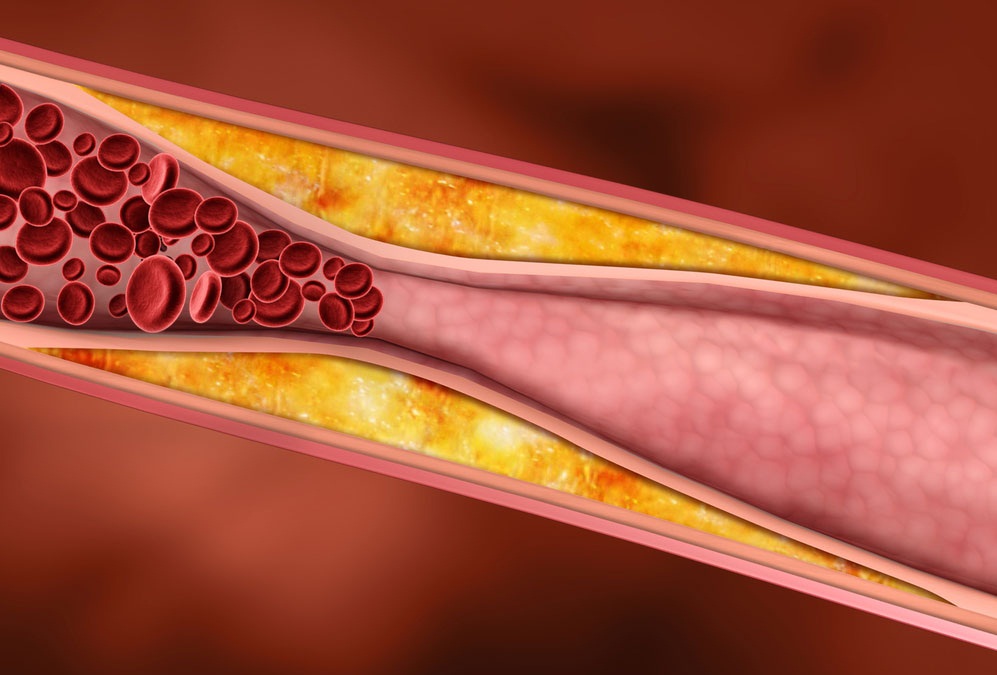 Nota/Articulo Nutrar