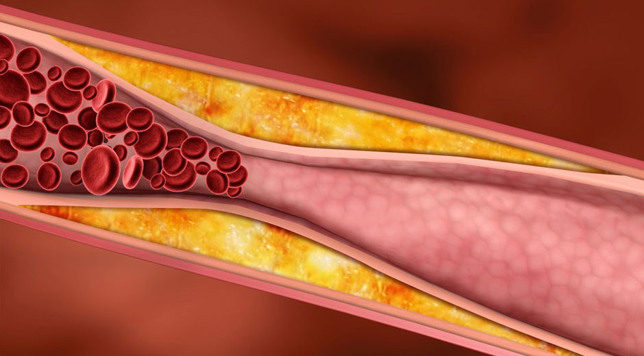 Nota/Articulo Nutrar